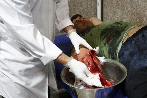 7 بار جراحی روی دست نارنجک ساز 7 بار جراحی روی دست نارنجک ساز