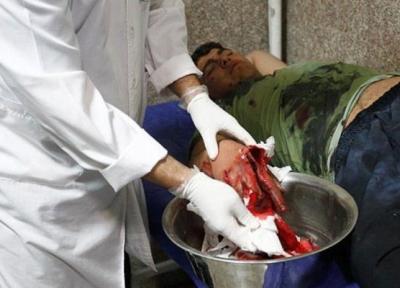 7 بار جراحی روی دست نارنجک ساز